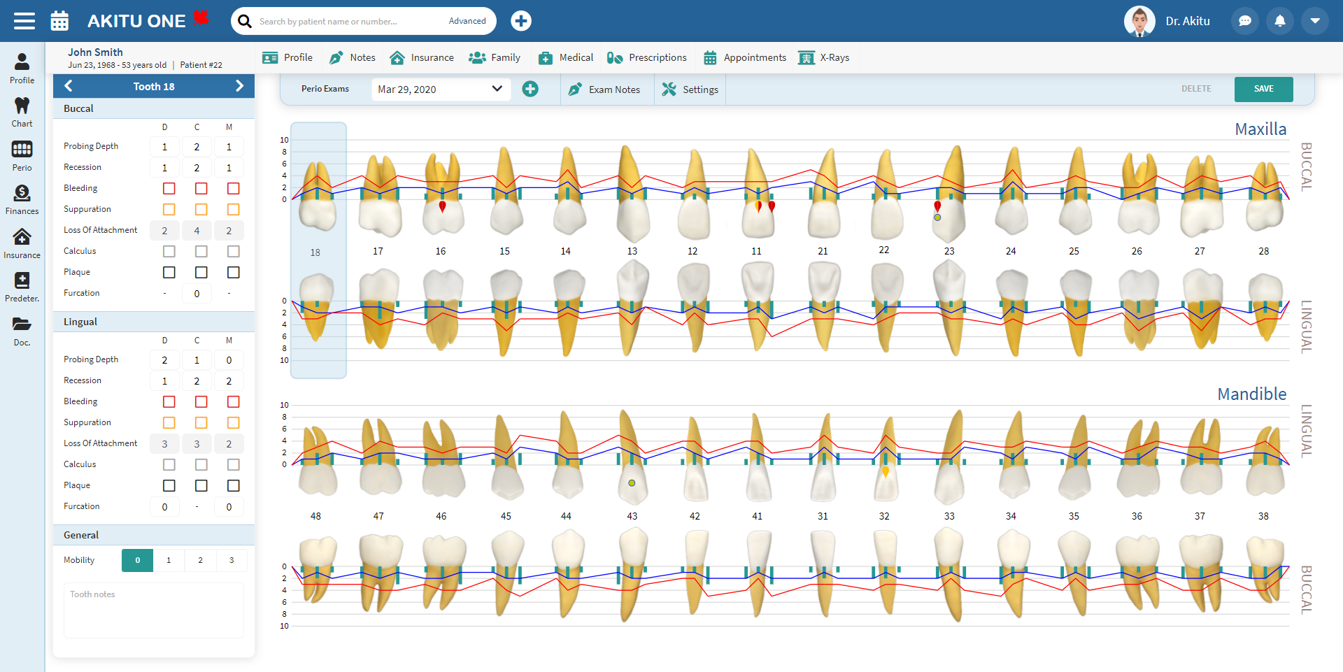 screenshot of Akitu One